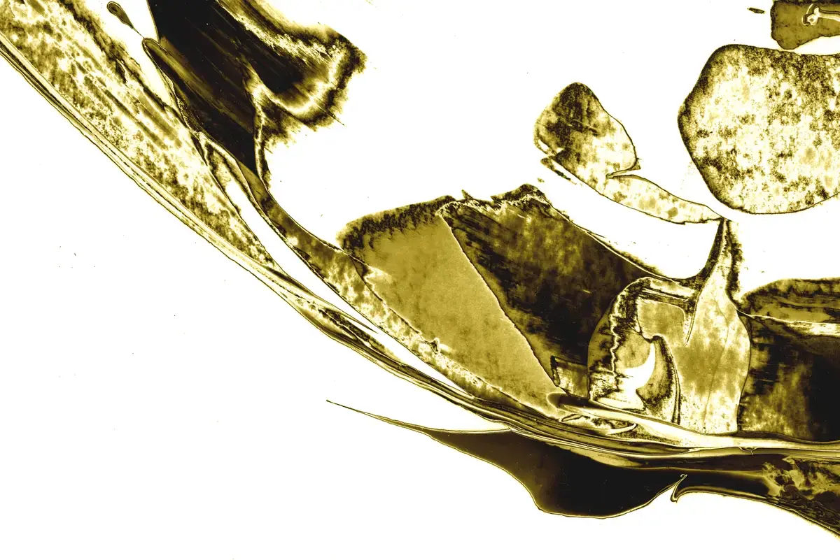 $12,800 Dental Gold - Crown and bridge collection from orthodontic practice